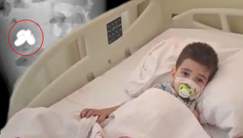 Mıknatıs ve Pil Yutan Çocuk: Sağlık Tehlikesi ve Sonuçları
