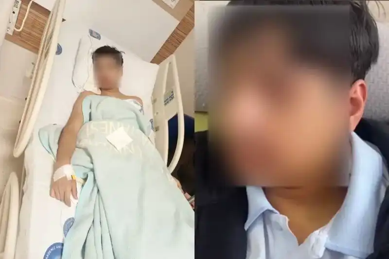 Antalya'da Akran Zorbalığı: Sırasına Oturduğu İçin Arkadaşının Çenesini Kırdı